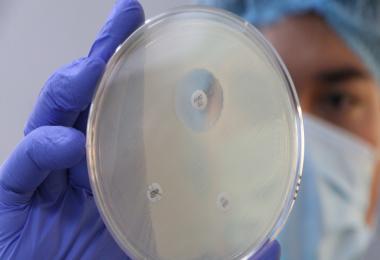 La edición 2025 de la Semana Mundial sobre la RAM tiene como lema: “Actuemos ya: protejamos nuestro presente, aseguremos nuestro futuro”